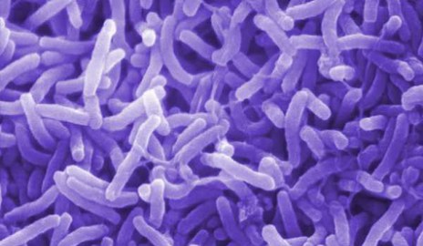 Vibrio cholerae bacterias